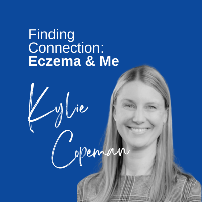 Eczema Support Australia Findingconnection Eczemaandmeblog